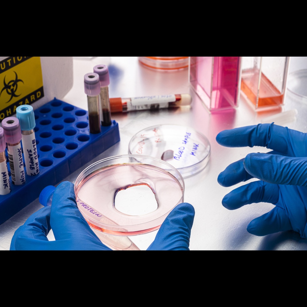E. Coli Recombinant Severe acute respiratory syndrome coronavirus 2 Spike glycoprotein ''S'', partial ''L452R&T478K''   500 ug